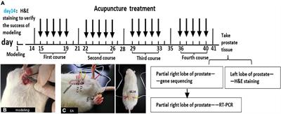 Effect of electroacupuncture on cyclic adenosine monophosphate-protein kinase A-vanillic acid receptor subtype 1 of the transient receptor potential/PLK-protein kinase C-vanillic acid receptor subtype 1 of the transient receptor potential pathway based on RNA-seq analysis in prostate tissue in rats with chronic prostatitis/chronic pelvic pain syndrome